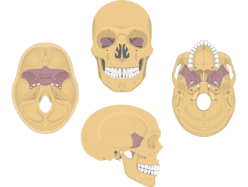Skull bone in an anterior, lateral, superior and inferior view with the sphenoid bone highlighted.