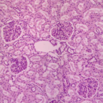 Histology slide of the kidney showing the renal medulla.