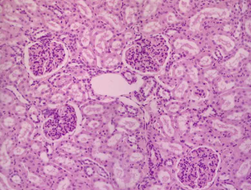 Histology slide of the kidney showing the renal medulla.