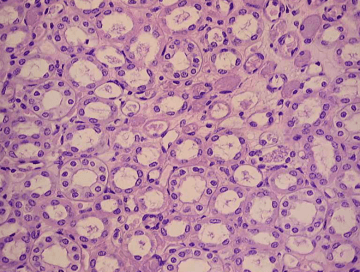 An HE-stained histology slide of the kidney showing the renal medulla.