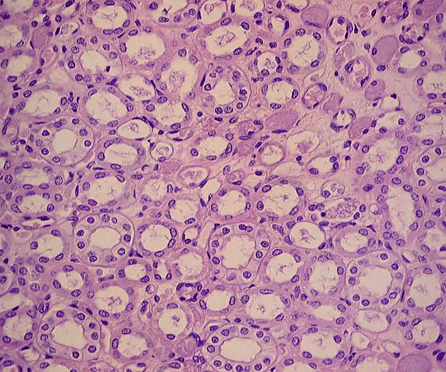 Renal Medulla Histology | Kidney
