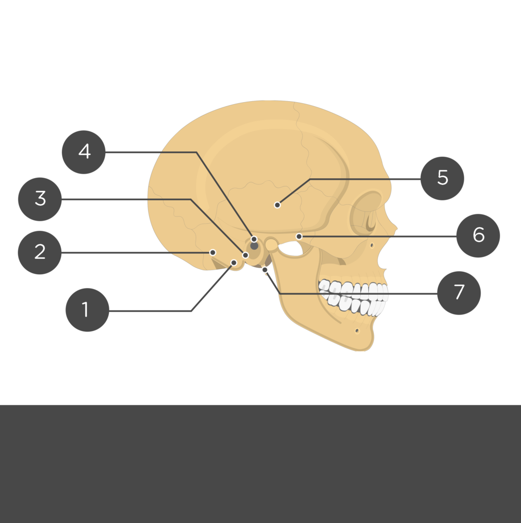 Test yourself - Temoporal bone lateral view
