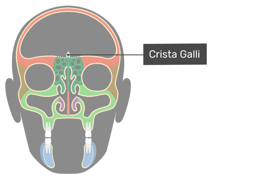 Coronal view of the crista galli highlighted and labeled.
