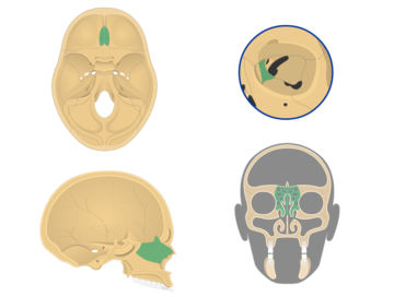 Different perspectives (anterior, superior, sagittal) of the skull emphasizing the location of ethmoid bone highlighted with green