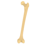 Femur bone - Posterior View - Featured