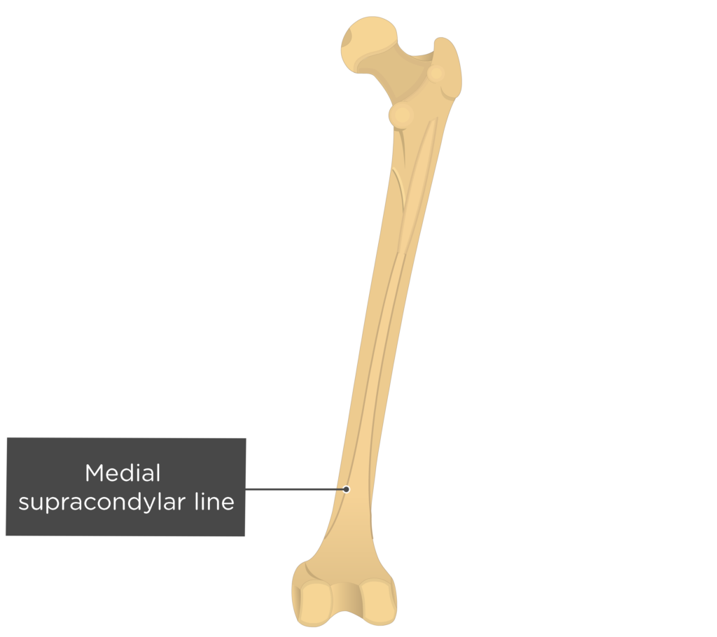 Medial supracondylar line - Femur bone