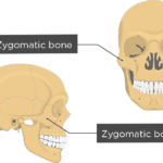 Skull illustration from an anterior and lateral perspective with a label pointing to the zygomatic bone.