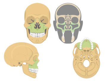 Different perspectives of the skull (anterior, lateral, coronal and inferior) showing the maxilla highlighted with green
