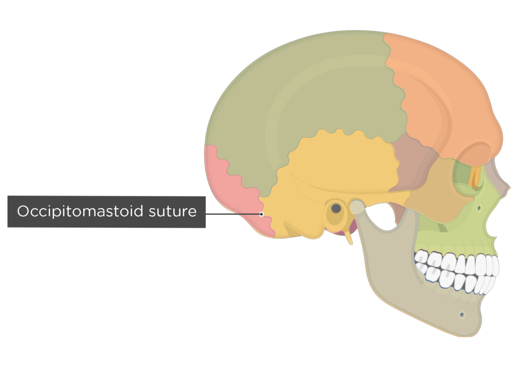 occipitomastoid suture - lateral view - divisions