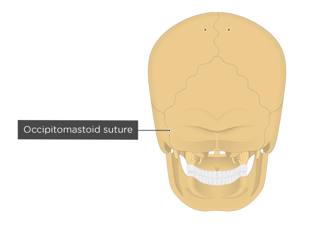 occipitomastoid suture - posterior view