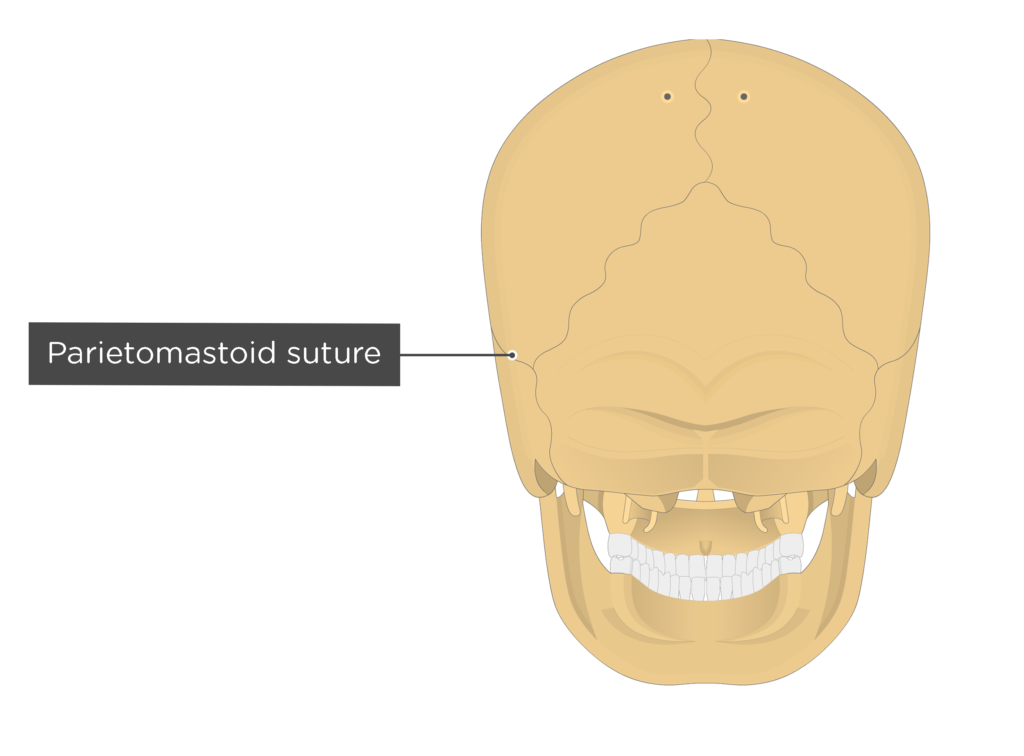 parietomastoid suture - posterior view