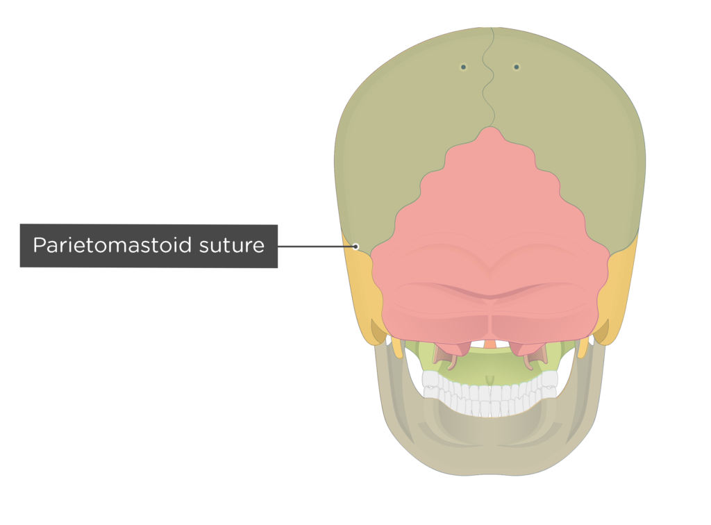 parietomastoid suture - posterior view - divisions