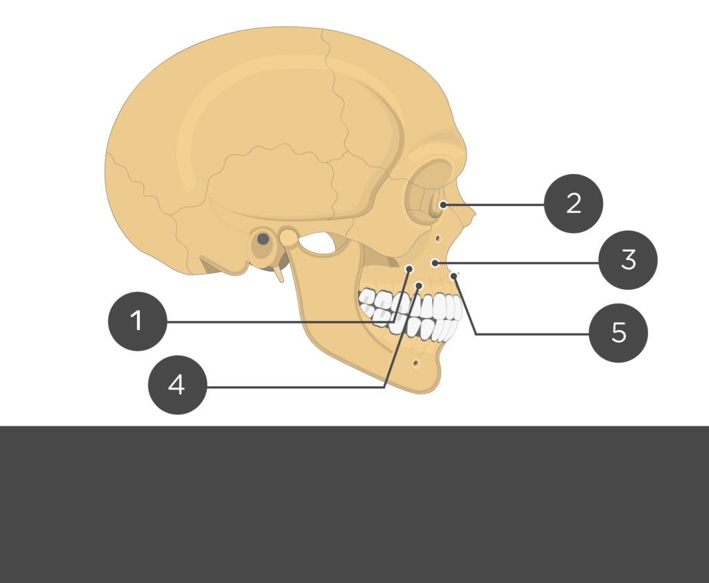 lateral view of the skull indicating maxilla parts