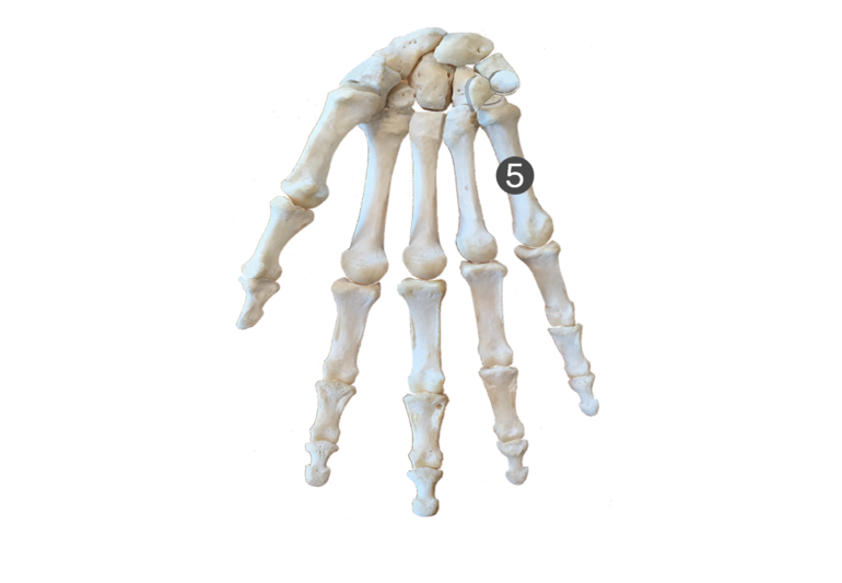 Metacarpal Bones: Anterior (Palmar) View