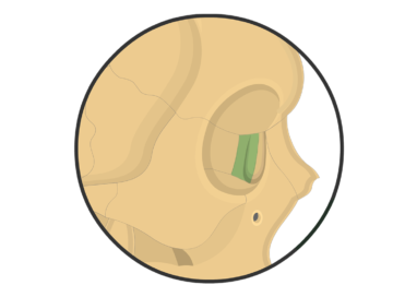 Lateral view of the skull showing the lacrimal bone highlighted with green