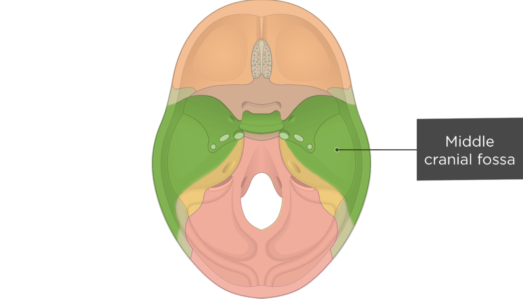 Fossa subarcuata. Middle Cranial Fossa. Anterior Cranial Fossa. Anterior Cranial Fossa meningiomas CT.
