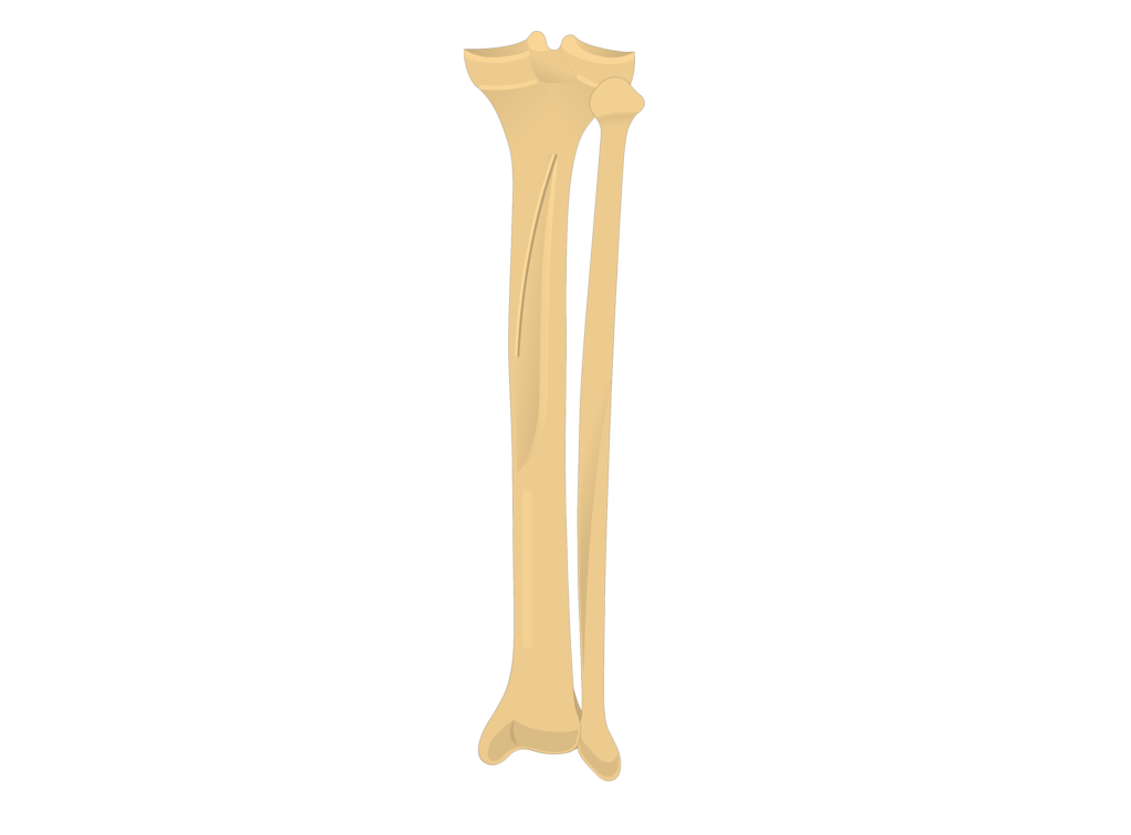 Curved tibia fibula. Tibula bone. os fibula.