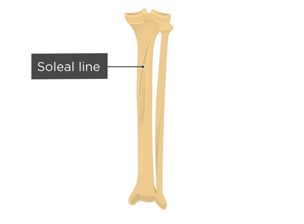 Curved tibia fibula. Tibia bone. fibulas латвия. fibula bone png.