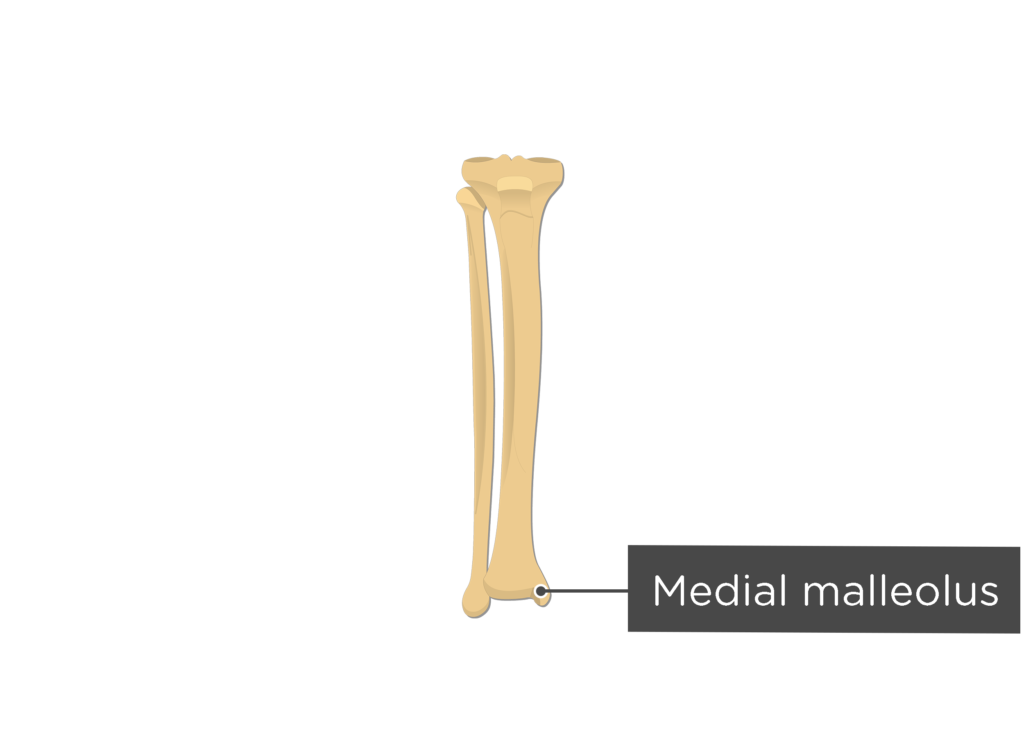 tibia fibula - anterior view - medial malleolus