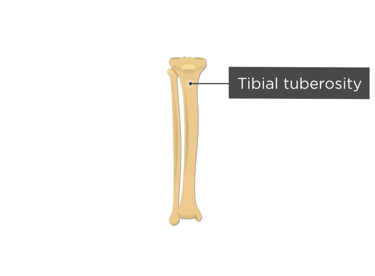 Curved tibia fibula. Tibial tuberosity. from tibial tuberosity препараты. устройство для инъекции tibial tuberosity.