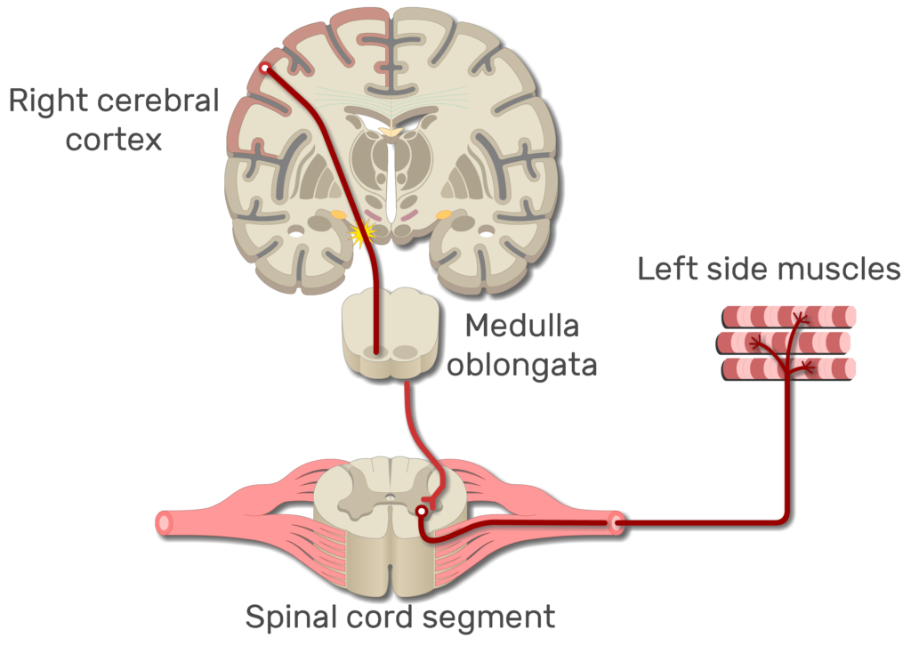 An image showing the action potential moving from the right cerebral cortex to left side muscles through the spinal cord
