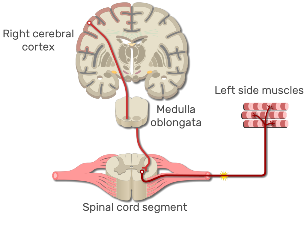 An image showing the action potential moving from the right cerebral cortex to left side muscles through the spinal cord