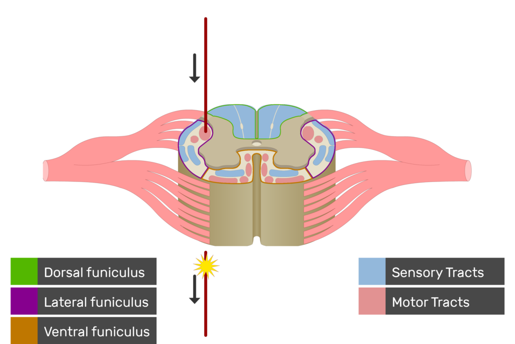 An image showing the motor tract action potential movement, Motor Tracts, Sensory Tracts, Ventral funiculus, Lateral funiculus and Dorsal funiculus inside the spinal cord segment