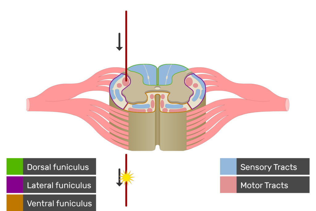 An image showing the motor tract action potential movement, Motor Tracts, Sensory Tracts, Ventral funiculus, Lateral funiculus and Dorsal funiculus inside the spinal cord segment
