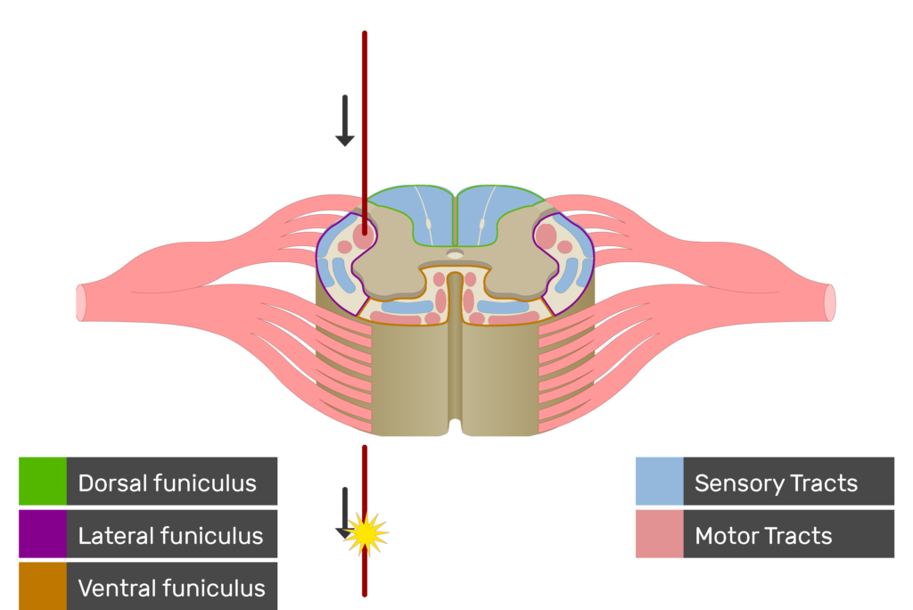 An image showing the motor tract action potential movement, Motor Tracts, Sensory Tracts, Ventral funiculus, Lateral funiculus and Dorsal funiculus inside the spinal cord segment