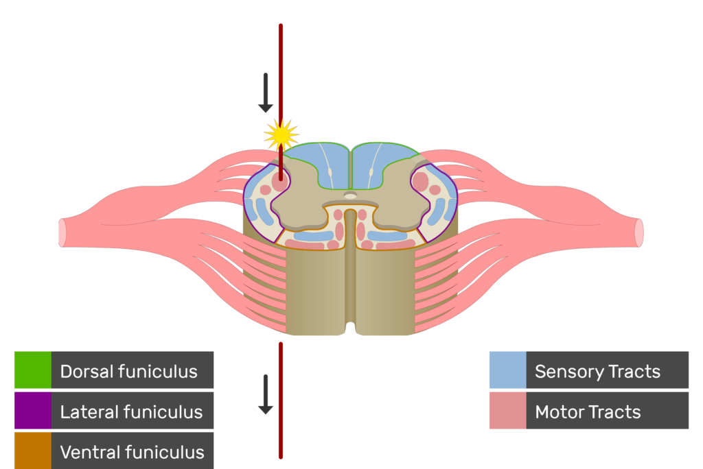 An image showing the motor tract action potential movement, Motor Tracts, Sensory Tracts, Ventral funiculus, Lateral funiculus and Dorsal funiculus inside the spinal cord segment