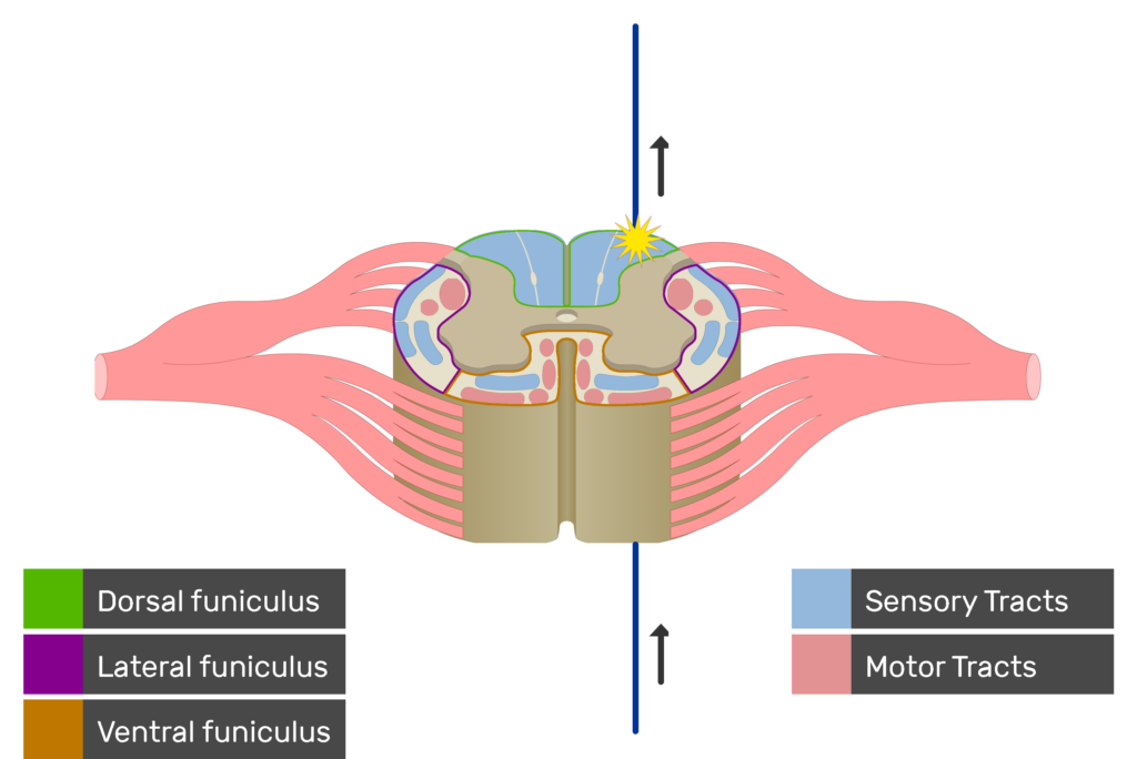 An image showing the sensory tract action potential movement, Motor Tracts, Sensory Tracts, Ventral funiculus, Lateral funiculus and Dorsal funiculus inside the spinal cord segment