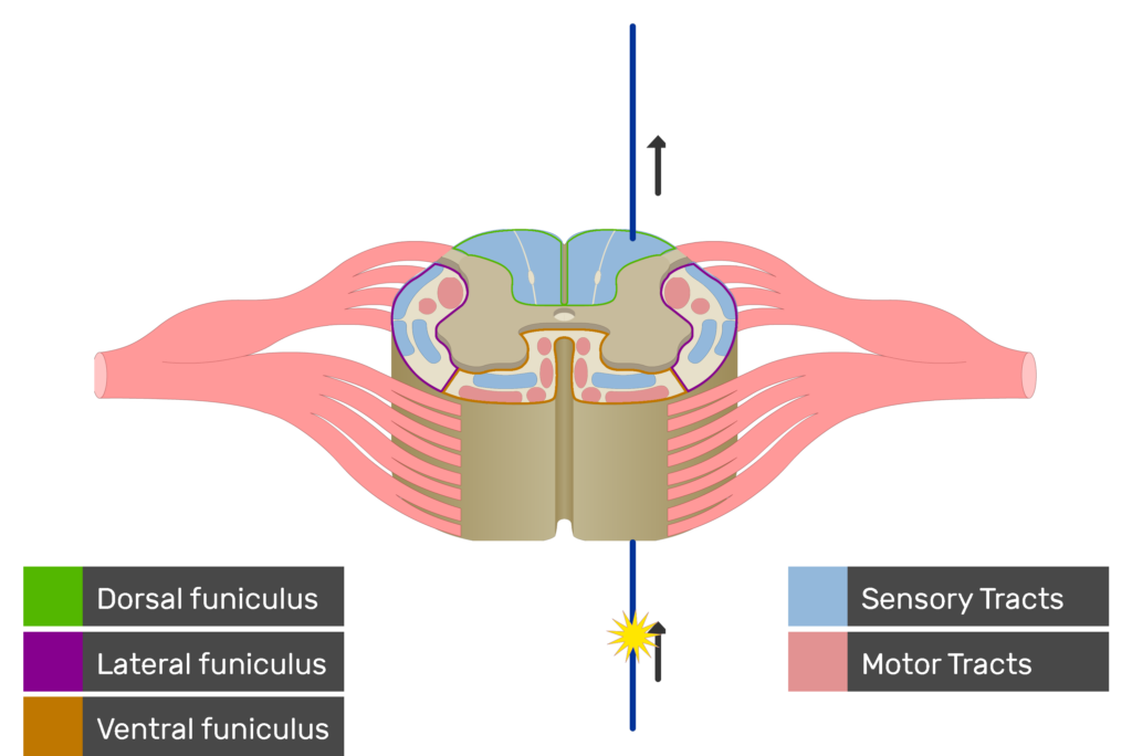 An image showing the sensory tract action potential movement, Motor Tracts, Sensory Tracts, Ventral funiculus, Lateral funiculus and Dorsal funiculus inside the spinal cord segment