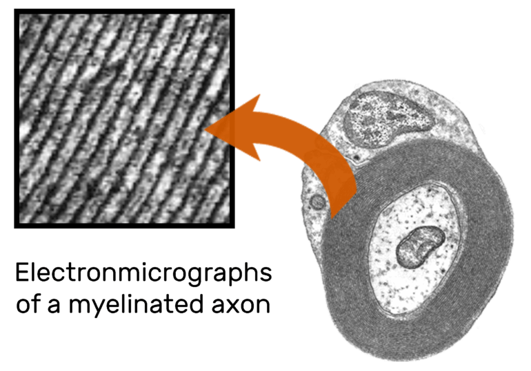 Myelination of Axons by Schwann Cells GetBodySmart
