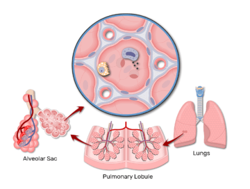 Zoomed-in lung alveolus which contains Type I/II cells, and the alveolus is found in alveolar sac which in turn located in pulmonary lobule