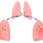 Mediastinal view of the lungs
