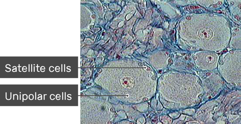 multipolar neuron labeled under microscope