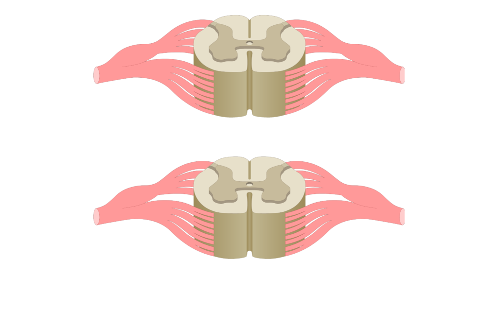 Cross section of the spinal cord showing 2 lumbar segments, gray matter, white matter and spinal nerve