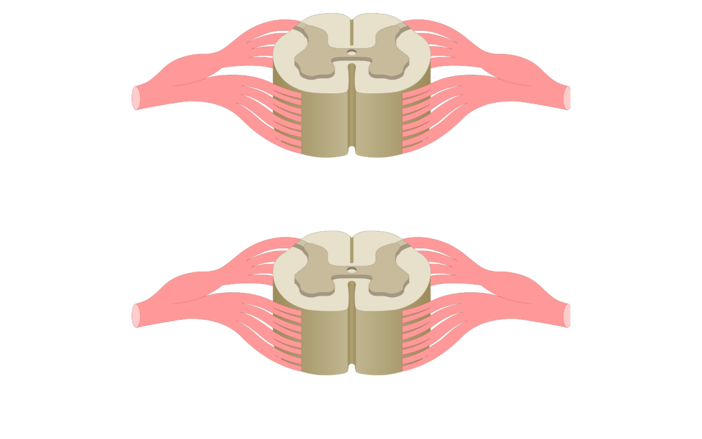 Cross section of the spinal cord showing 2 lumbar segments, gray matter, white matter and spinal nerve
