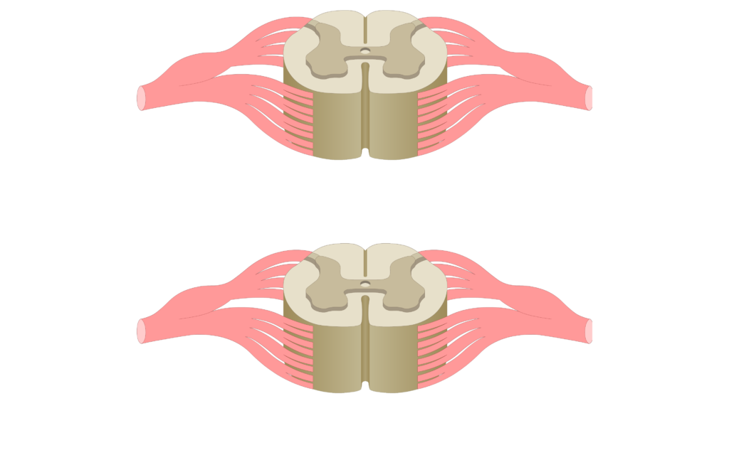 Cross section of the spinal cord showing 2 lumbar segments, gray matter, white matter and spinal nerve
