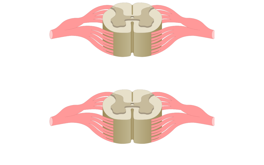 Cross section of the spinal cord showing 2 lumbar segments, gray matter, white matter and spinal nerve
