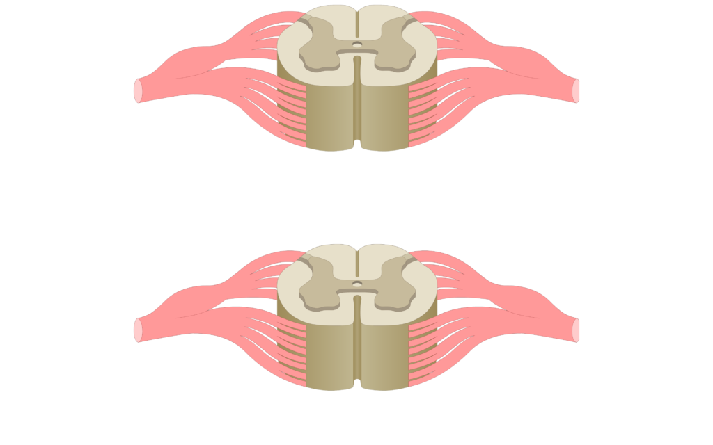 Cross section of the spinal cord showing 2 lumbar segments, gray matter, white matter and spinal nerve