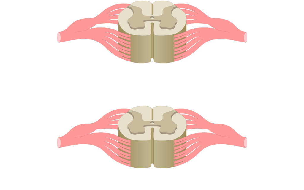 Cross section of the spinal cord showing 2 lumbar segments, gray matter, white matter and spinal nerve