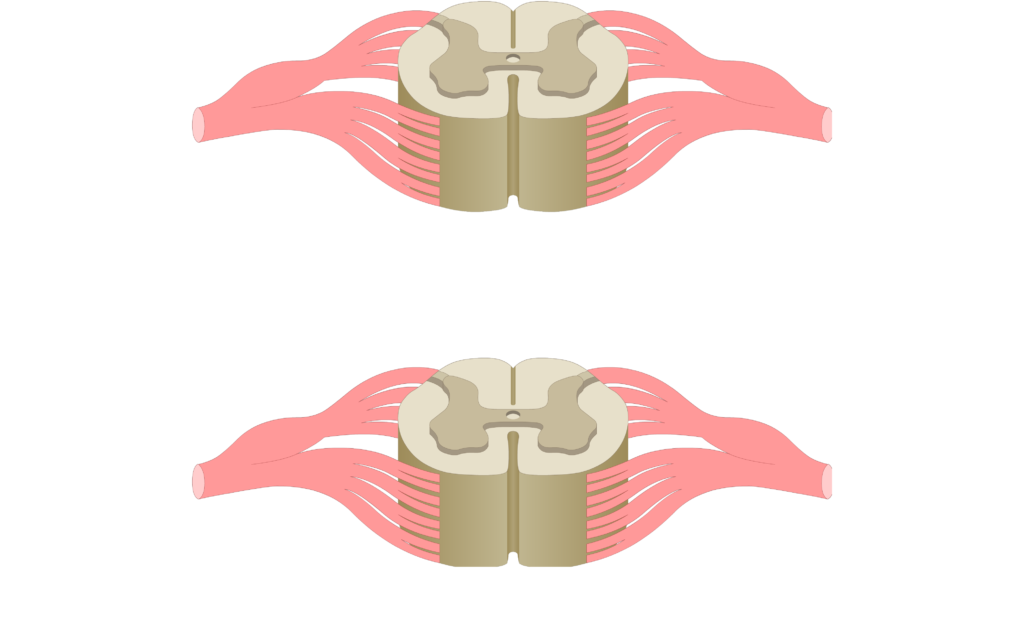 Cross section of the spinal cord showing 2 lumbar segments, gray matter, white matter and spinal nerve