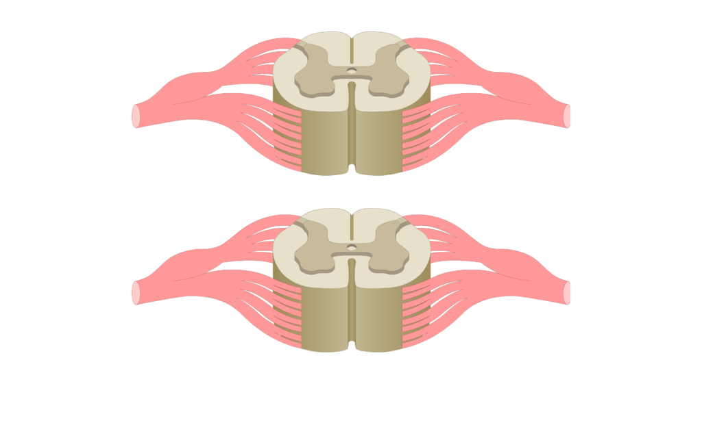 Cross section of the spinal cord showing 2 lumbar segments, gray matter, white matter and spinal nerve