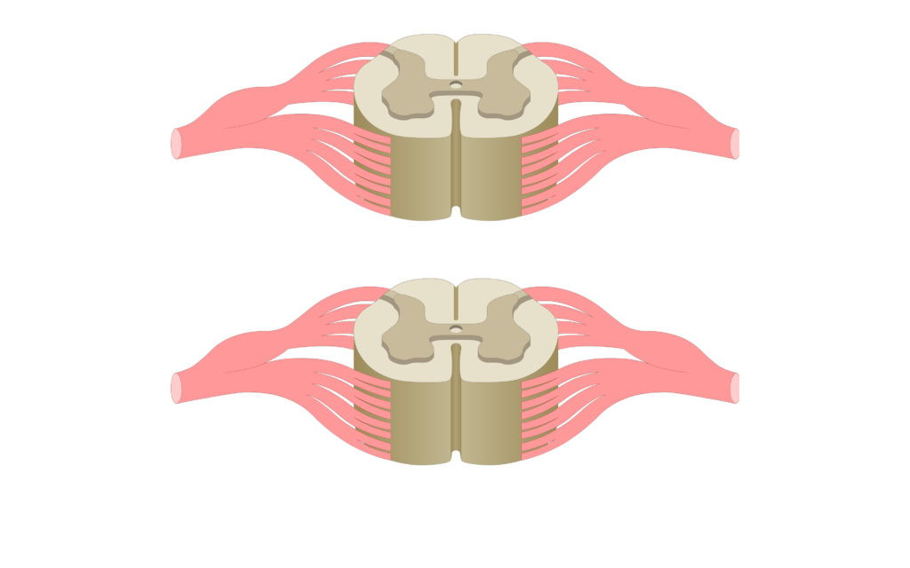 Cross section of the spinal cord showing 2 lumbar segments, gray matter, white matter and spinal nerve
