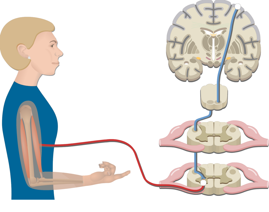 An image showing the muscle response, the action potential passed the pathway, Pyramidal Tract Pathway (Internal capsule, Corticospinal tract, Medulla pyramid, Primary motor cortex, Upper motor neuron, Lower motor neuron)