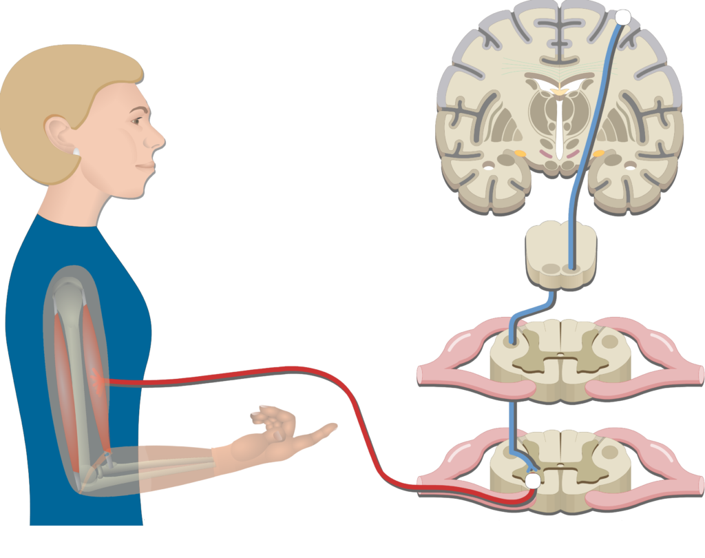 An image showing the muscle response, the action potential passed the pathway, Pyramidal Tract Pathway (Internal capsule, Corticospinal tract, Medulla pyramid, Primary motor cortex, Upper motor neuron, Lower motor neuron)