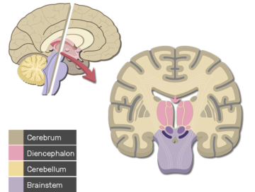 Brain Anatomy model simple Quiz