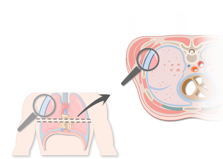Pleura (or Pleurae) and Pleural Cavity of the Lungs
