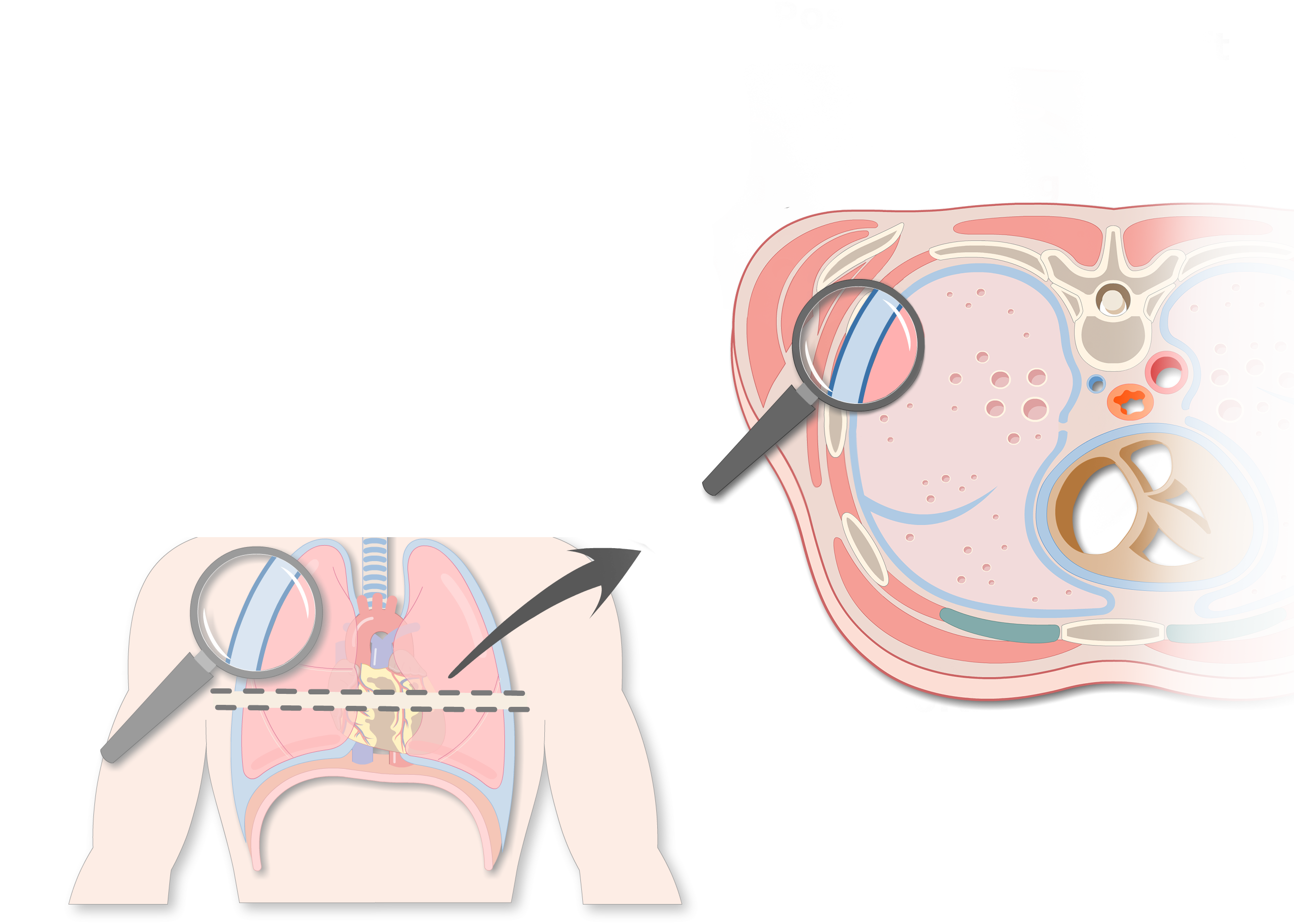 Parietal Pleura:  Serous Membrane Secrets Revealed - 639q5es